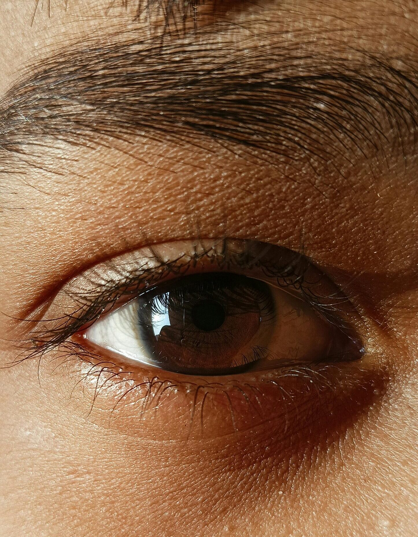 traitement cernes et contour des yeux médecine esthétique