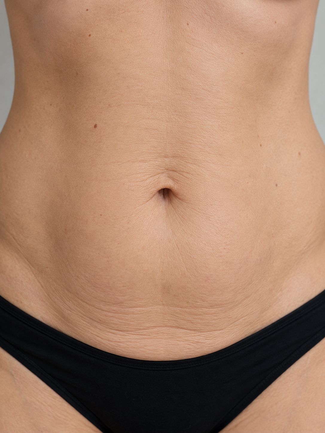 tightsculpting