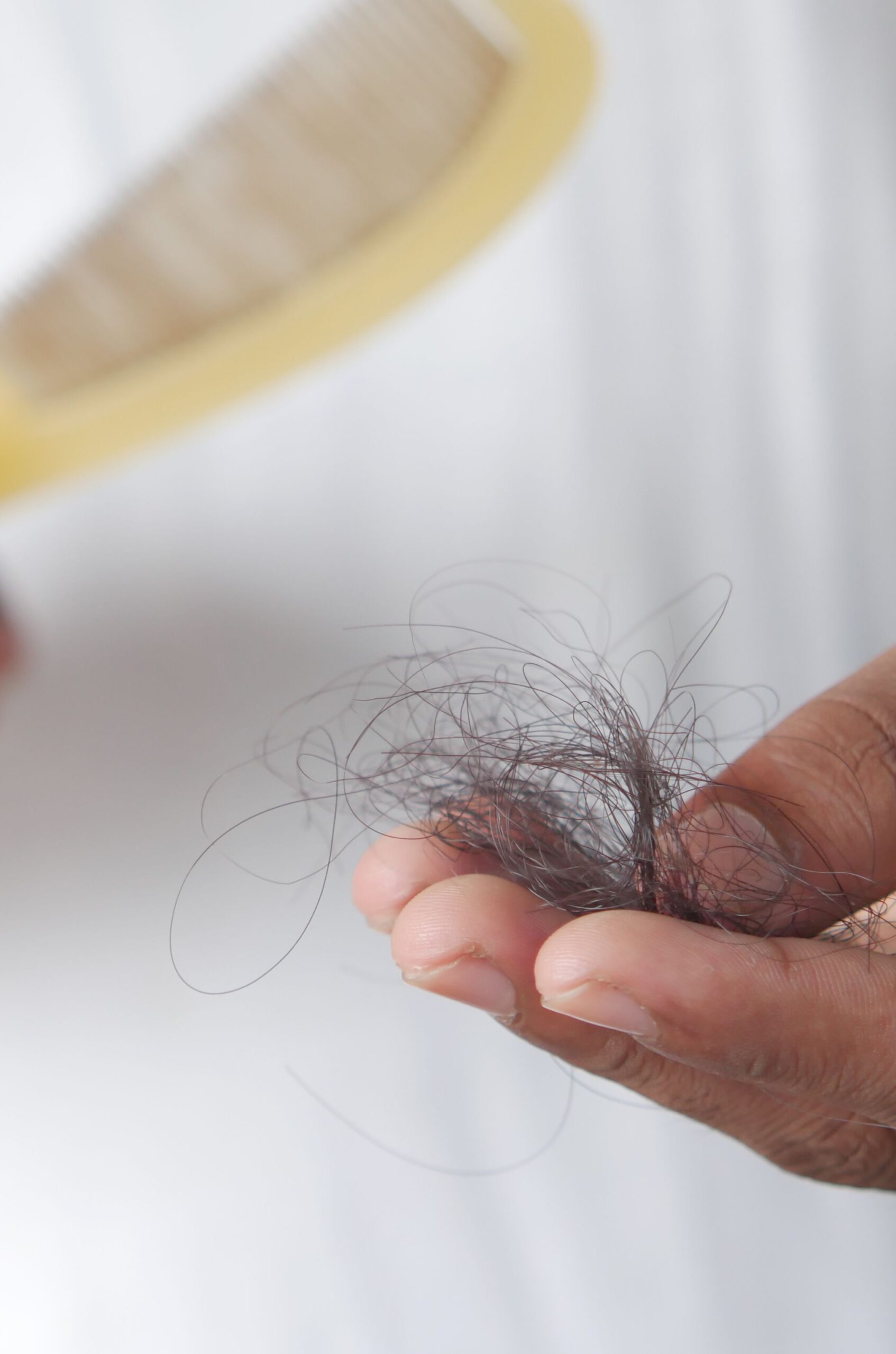 Chute de cheveux